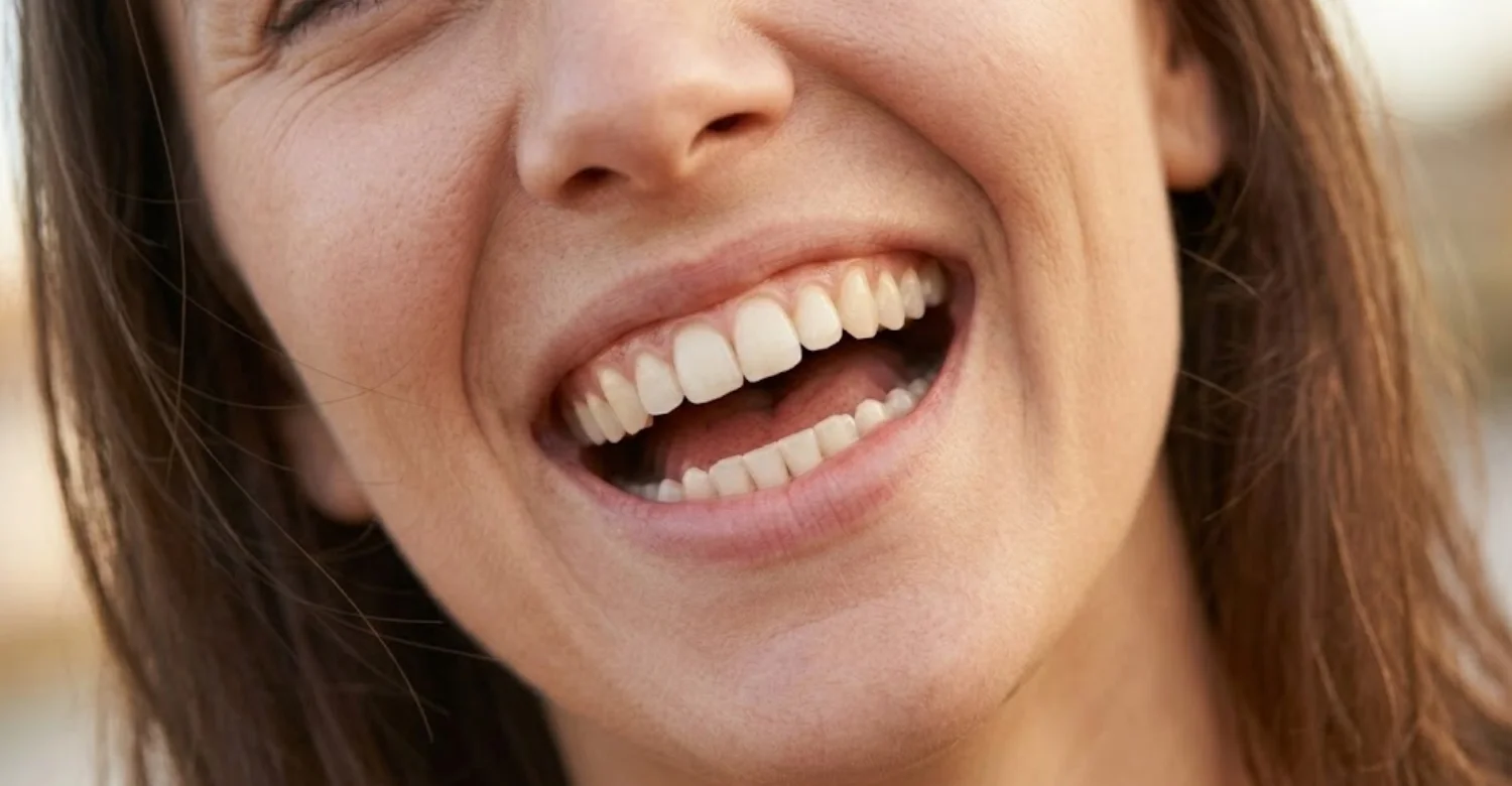 Sodium Fluoride Dental Gel inblog